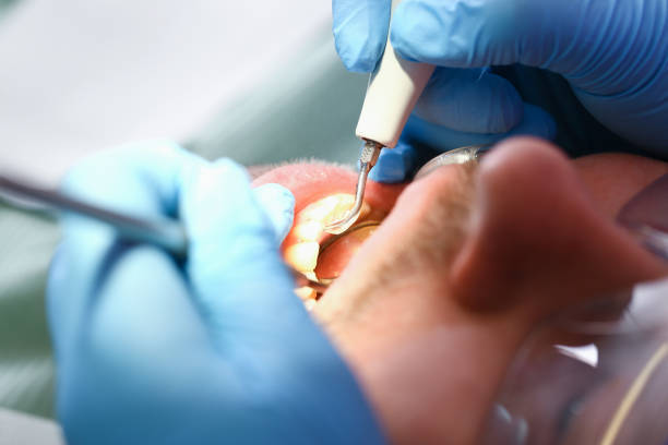 Best Emergency Care for Gum Disease in Johnson Lane, NV