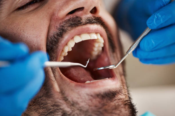 Best Emergency Denture Repair in Johnson Lane, NV