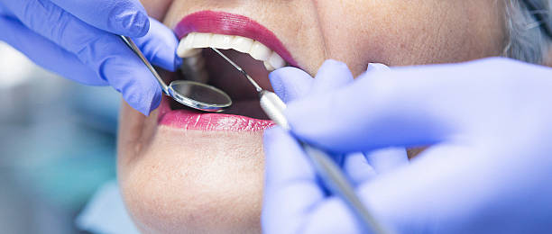 Best Knocked-Out Tooth (Avulsed Tooth) Treatment in Johnson Lane, NV
