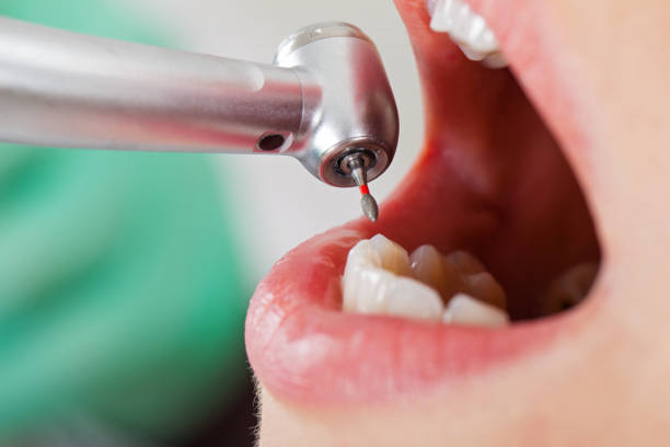 Best Emergency Root Canal Therapy in Johnson Lane, NV